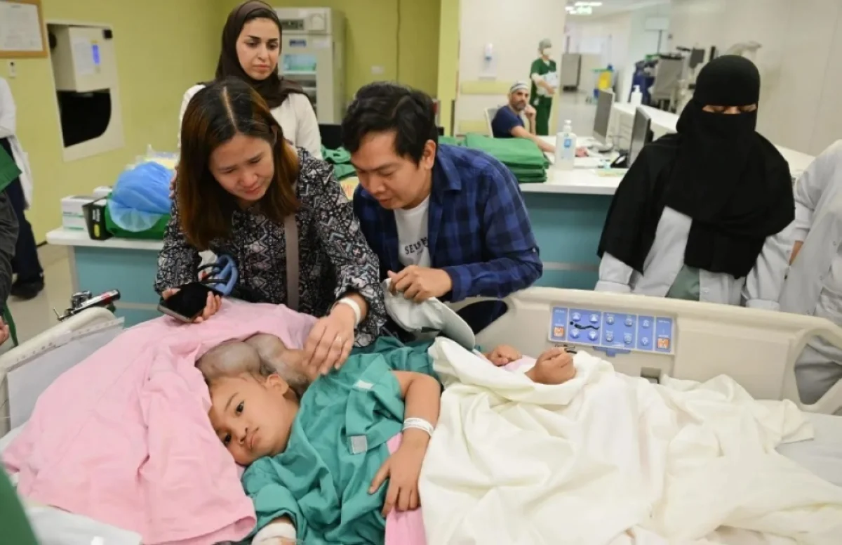 نجاح عملية فصل التوأم الفلبيني كليا وموريس آن في الرياض